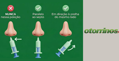 A posição da lavagem nasal faz a diferença! destaque