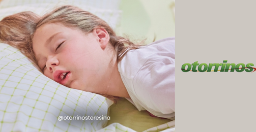 Respiração pela boca está remodelando o rosto do seu filho enquanto ele dorme destaque