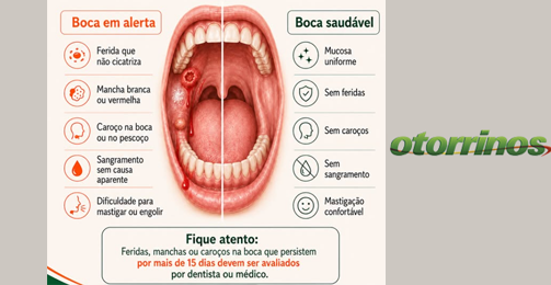 Quais sinais podem indicar câncer de boca? destaque