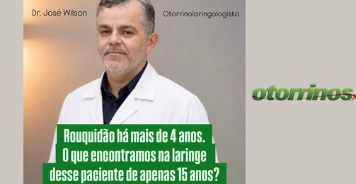 Rouquidão há mais de 4 anos. o que encontramos na laringe desse paciente apenas 15 anos? destaque